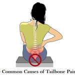 5 Common Causes of Tailbone Pain