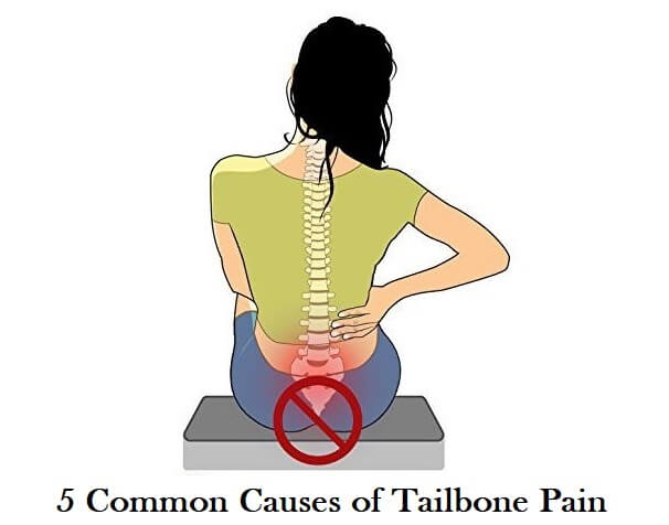 causes of tailbone or coccydynia pain
