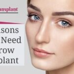 11 Reasons People Need Eyebrow Transplant
