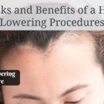 The Risks and Benefits of a Hairline Lowering Procedures