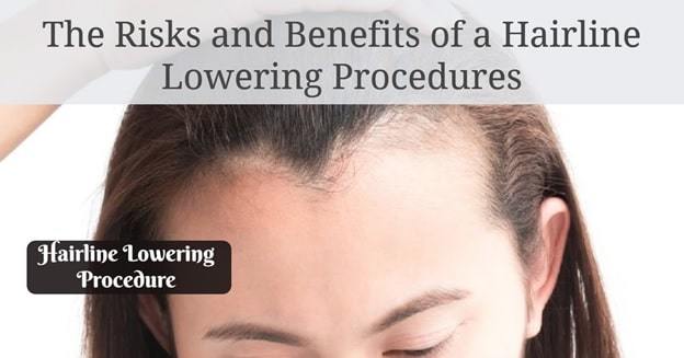 hairline lowering procedure