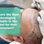 What Are The Best Technologies Available In The Market For Hair Transplant?