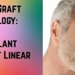 Smart Graft Technology: Hair Transplant Without Linear Scars
