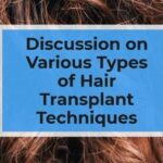 Discussion on Various Types of Hair Transplant Techniques