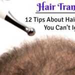 12 Tips About Hair Transplant You Can't Ignore