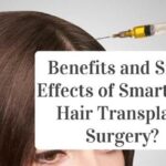 Benefits and Side-Effects of Smart PRP Hair Transplant Surgery