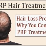 Hair Loss Problem? Why You Consider PRP Treatment