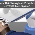 Robotic Hair Transplant- Procedure of ARTAS Robotic System?