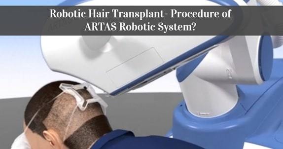 artas robotic hair restoration