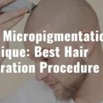 Scalp Micropigmentation Technique: Best Hair Restoration Procedure
