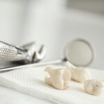 Wisdom Tooth Extraction Aftercare: 10 Tips for Ensuring a Speedy Recovery