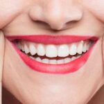 How Cosmetic Dentistry Can Remake Your Precious Smile for Life?