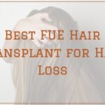 Best FUE Hair Transplant for Hair Loss