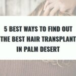 5 Best Ways to Find Out the Best Hair Transplant in Palm Desert