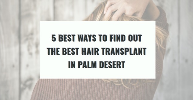 hair transplant clinic in palm desert