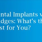Dental Implants vs. Bridges: What's the Best for You?