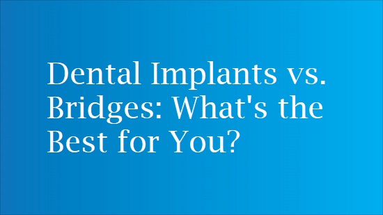 bridge vs implant pros cons