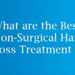 What are the Best Non-Surgical Hair Loss Treatment