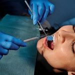 What Various Forms of Cosmetic Dentistry Treatment Can You Choose?