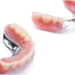 The Differences Between Dentures and Their Cost