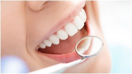 beautiful smiles with smile makeover