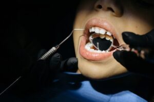 close-up shot of a kid having dental checkup